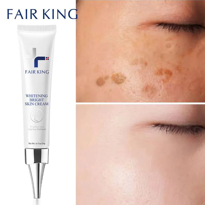 Dark Spot Corrector Skin Whitening Fade Cream Lightening Blemish Removal Serum Reduces Age Spots Freckles Face Cream 20g - Sellinashop
