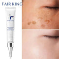 Dark Spot Corrector Skin Whitening Fade Cream Lightening Blemish Removal Serum Reduces Age Spots Freckles Face Cream 20g - Sellinashop