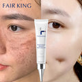 Dark Spot Corrector Skin Whitening Fade Cream Lightening Blemish Removal Serum Reduces Age Spots Freckles Face Cream 20g - Sellinashop