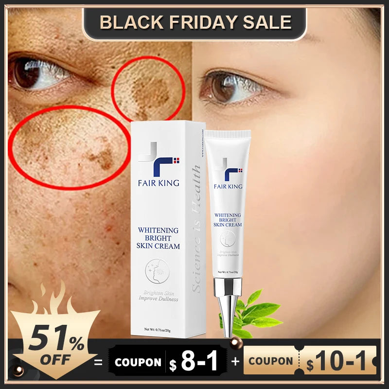 Dark Spot Corrector Skin Whitening Fade Cream Lightening Blemish Removal Serum Reduces Age Spots Freckles Face Cream 20g - Sellinashop